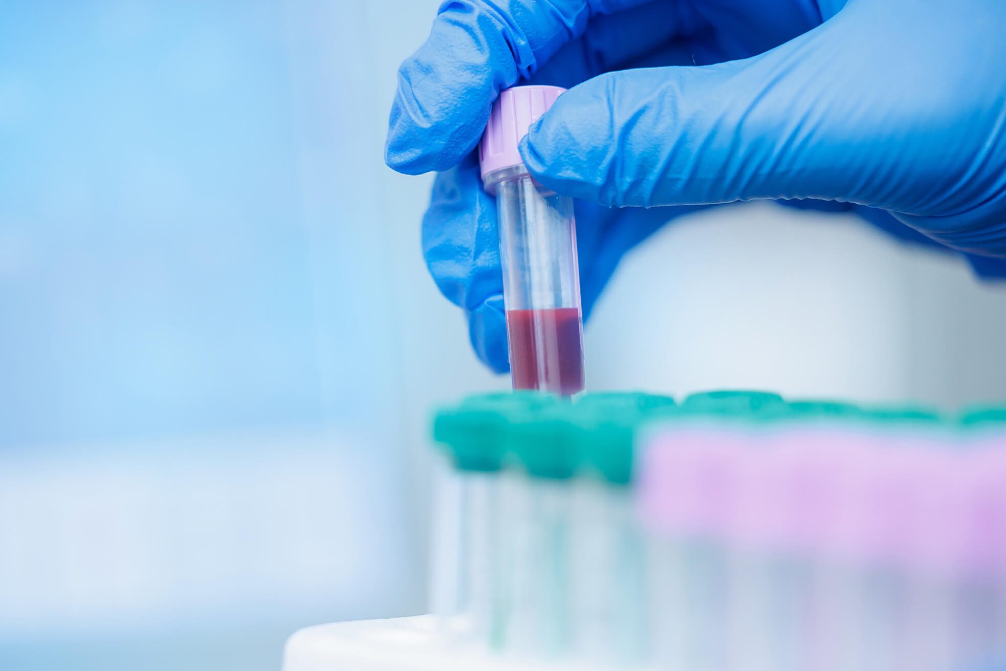 closeup of gloved hand holding a vial of blood